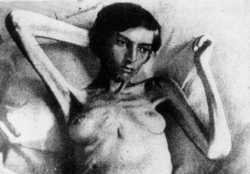 starved femail prisoner at Sachsenhausen